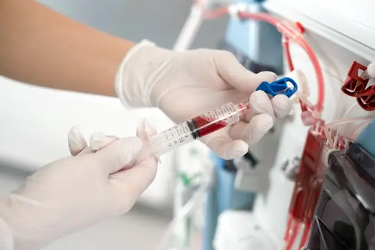 Hemodiafiltration Treatment